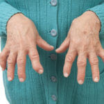 Arthritis And Receiving Disability Benefits