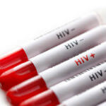Disability Benefits for HIV Positive Americans