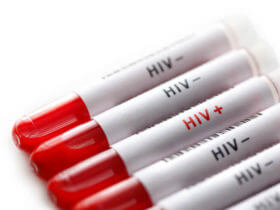 Disability Benefits for HIV Positive Americans