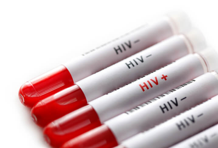 Disability Benefits for HIV Positive Americans