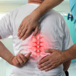 Spondylosis Disability