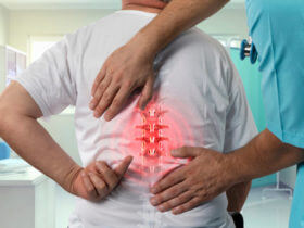 Spondylosis Disability