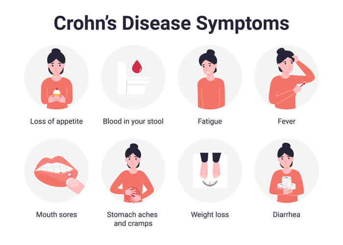 Crohn's disease symptoms infographic