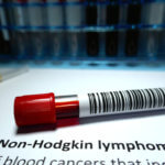 Non-Hodgkin Lymphoma and Getting Social Security Disability