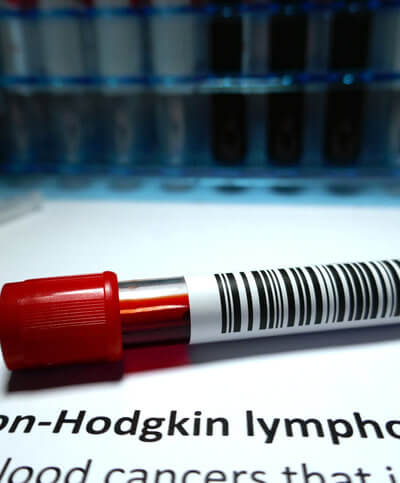 Non-Hodgkin Lymphoma and Getting Social Security Disability