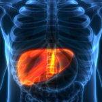 How to Get Disability Benefits for Liver Cancer