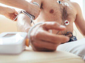Does Atrial Fibrillation (A-Fib) Qualify for SSD Benefits?