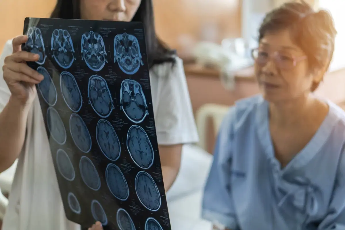 How to get TBI Disability Benefits for Brain Damage