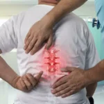 How to Get Disability for Spondylosis